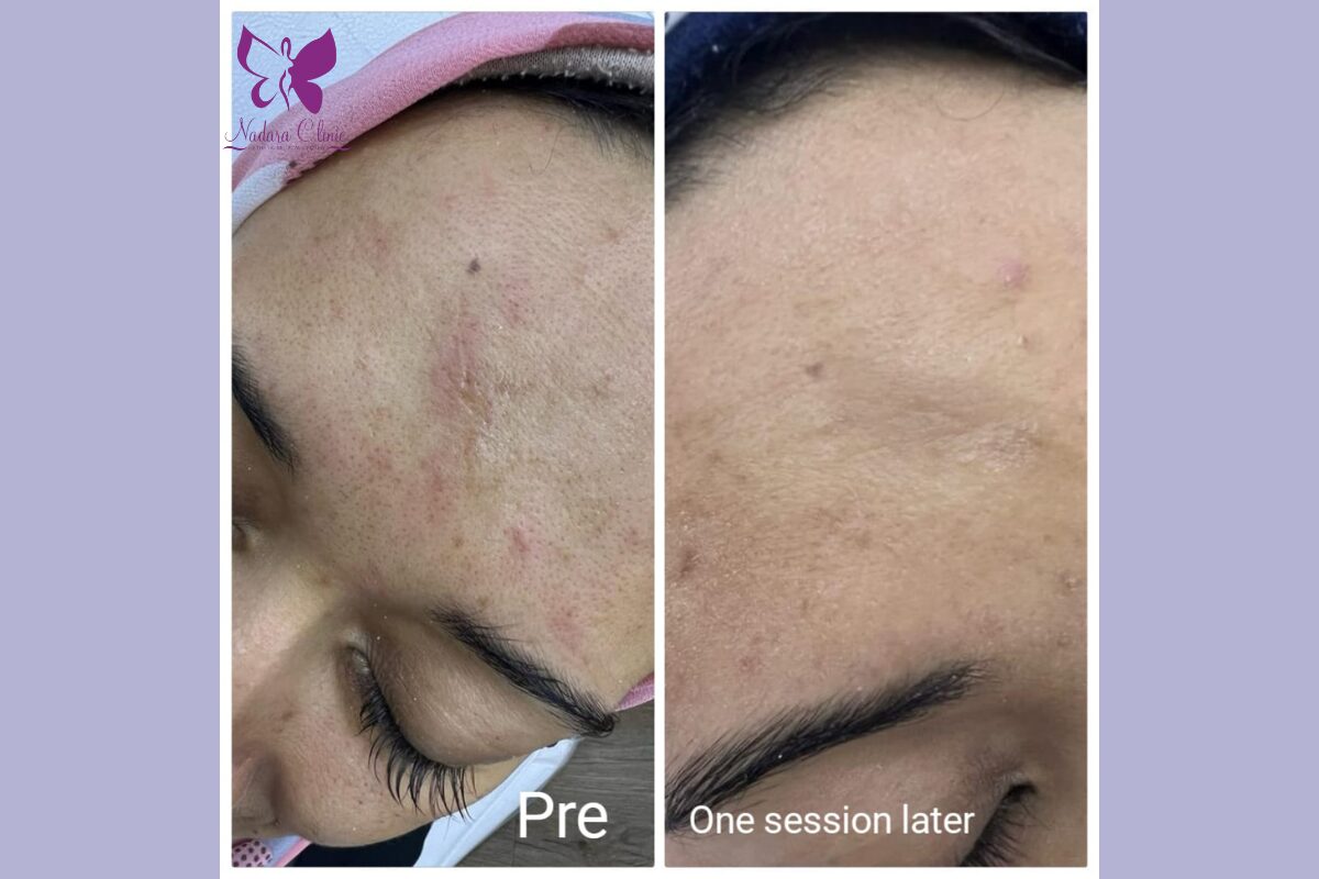 اطباء ازالة ندوب الوجه في الغردقة